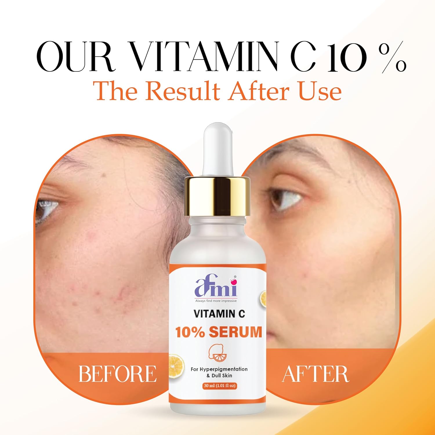 Afmi Vitamin C 10% Serum for Hyperpigmentation & Dull Skin, 30ml