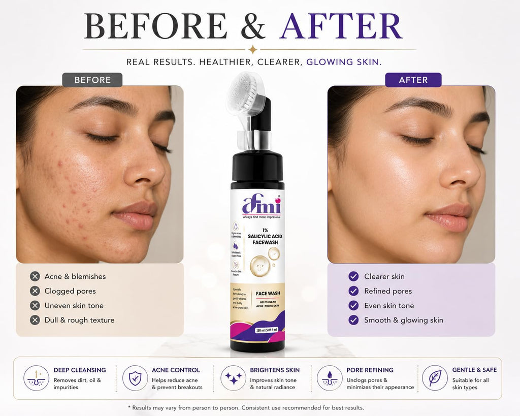 AFMI 1% Salicylic Acid Face Wash for Oily & Acne-Prone Skin | Deep Cleansing Foaming Face Cleanser with Soft Brush Applicator | Daily Use Face Wash for Men & Women | 150 ml