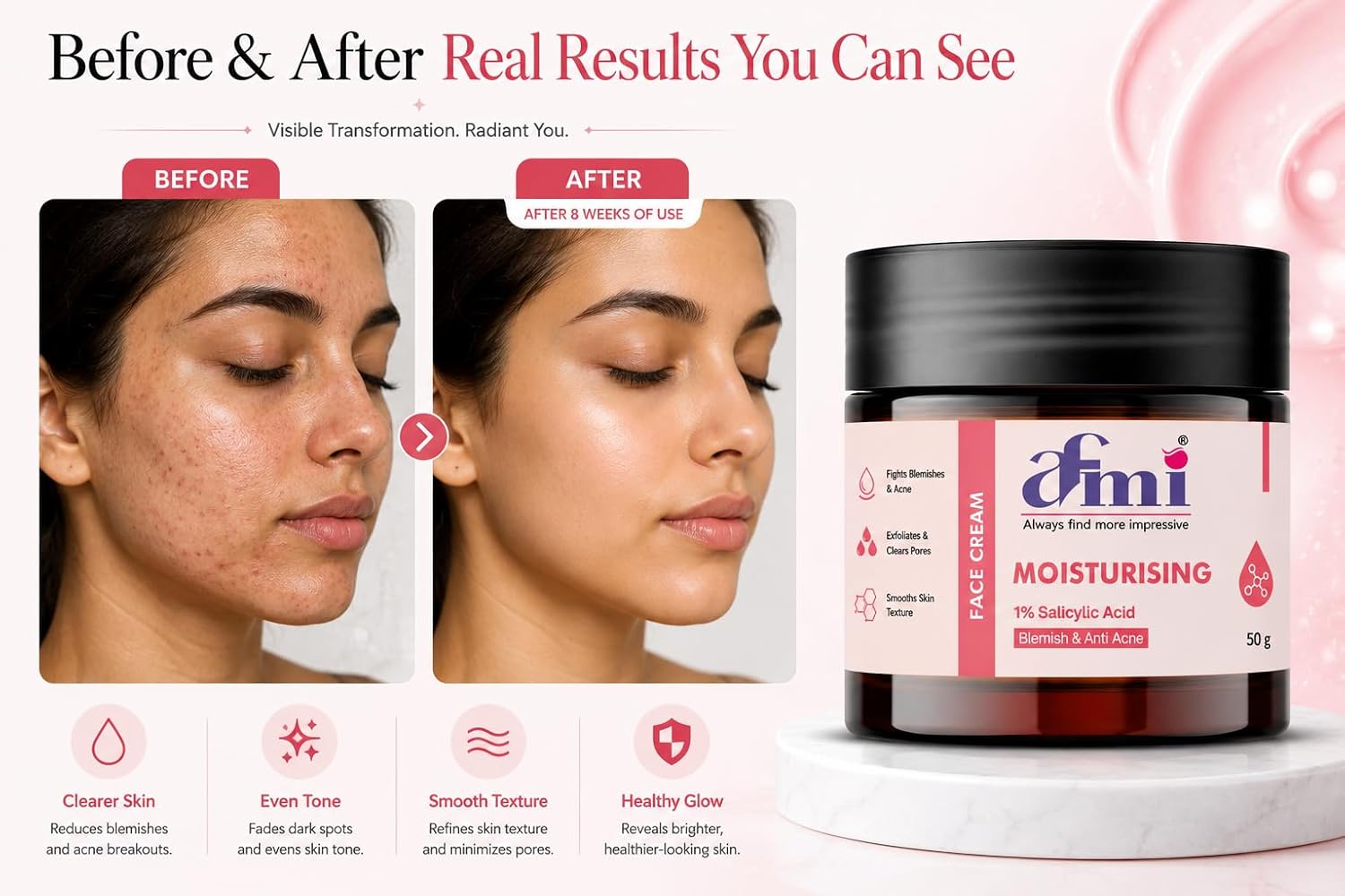 AFMI Moisturising Face Cream with 1% Salicylic Acid for Blemish & Acne Care | Lightweight Hydrating Formula for Oily & Acne-Prone Skin | Daily Use Face Moisturiser | 50 g