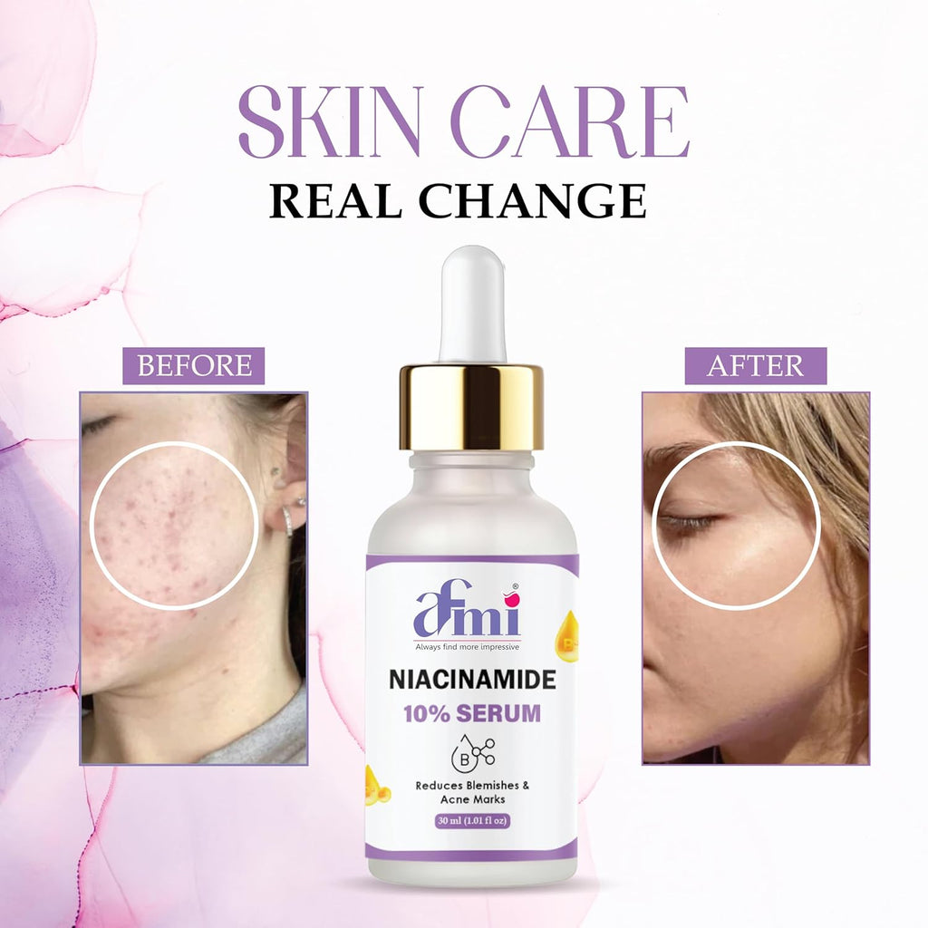 Afmi Niacinamide 10% Serum, Reduces Blemishes & Acne Marks, 30ml, Face Treatment, All Skin Types, Unscented