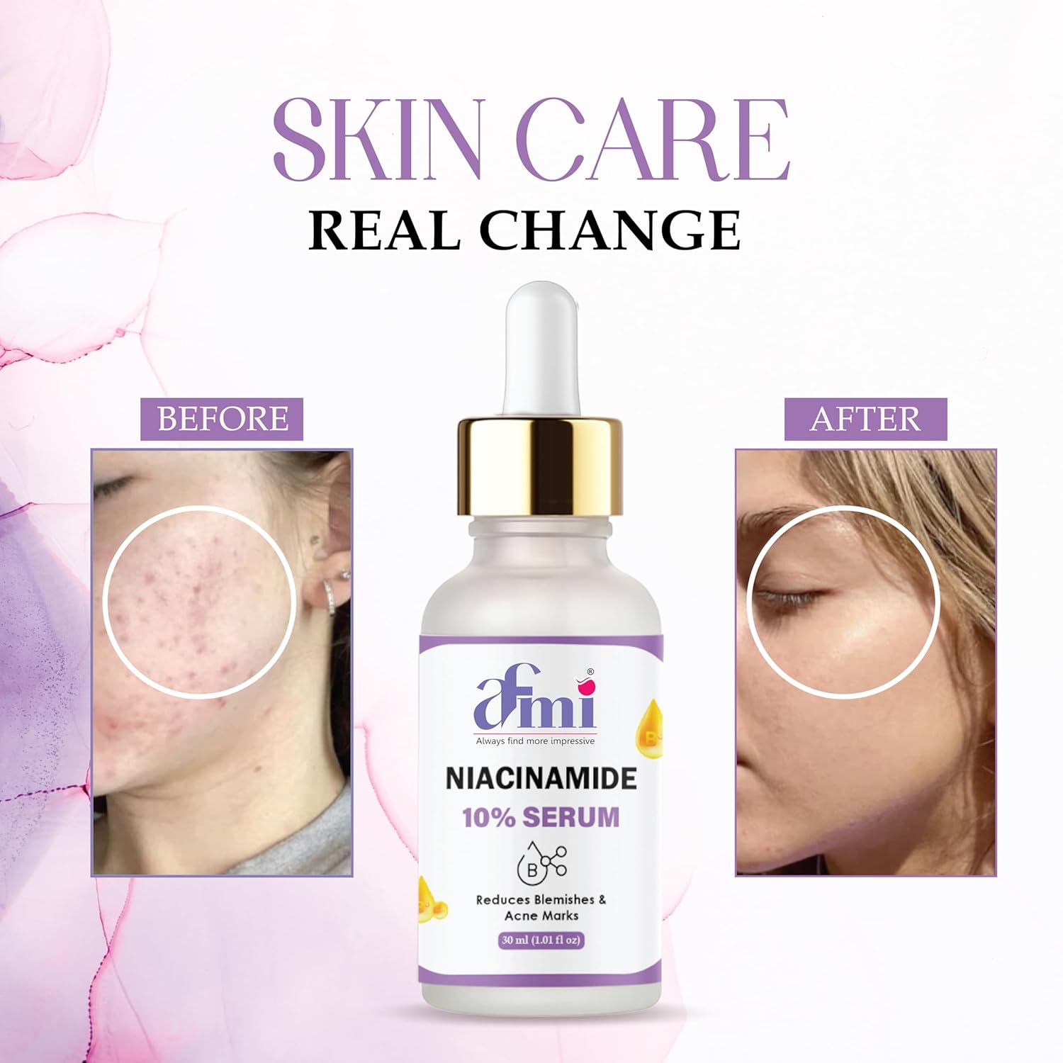 Afmi Niacinamide 10% Serum, Reduces Blemishes & Acne Marks, 30ml, Face Treatment, All Skin Types, Unscented