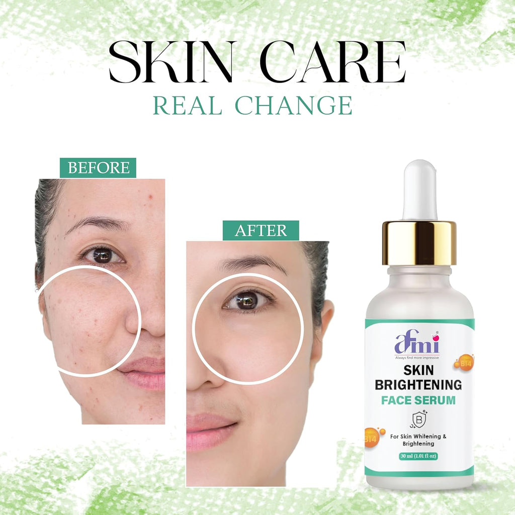 Afmi Skin Brightening Face Serum with B14, for Skin Whitening & Brightening, 30ml