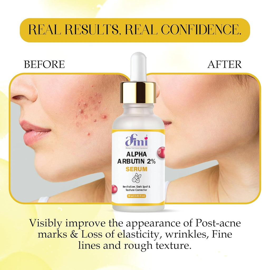 AFMI Alpha Arbutin 2% Serum, Revitalizer Dark Spot & Texture Corrector, 30ml