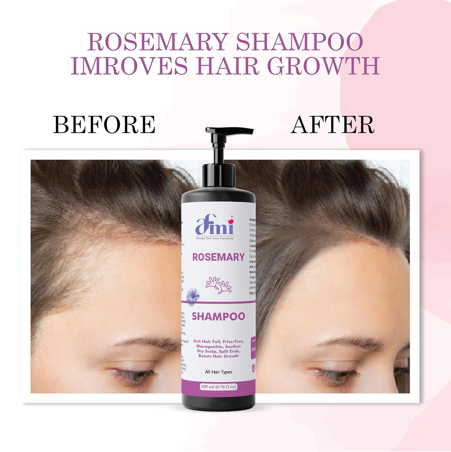 Afmi Shampoo, Anti Hair Fall, Frizz-Free, Boosts Hair Growth, Soothes Dry Scalp, All Hair Types, 200ml (Rosemary shampoo)