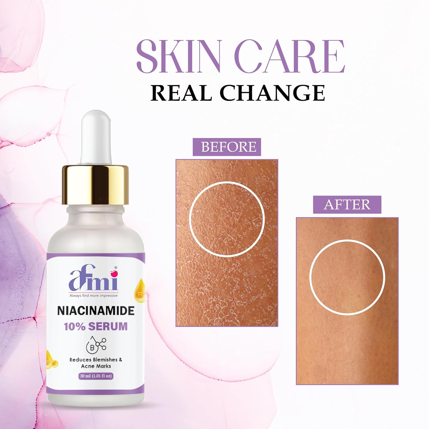 Afmi Niacinamide 10% Serum, Reduces Blemishes & Acne Marks, 30ml, Face Treatment, All Skin Types, Unscented